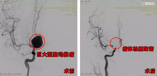 QQ截图20181031112211.png