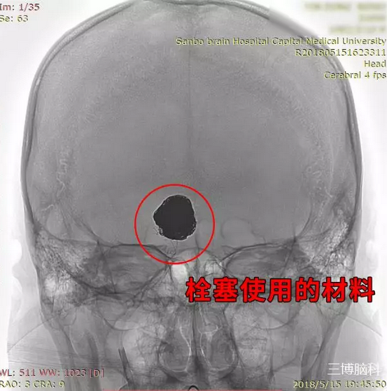 QQ截图20181031112236.png