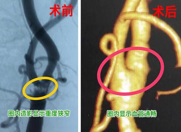 QQ截图20181106165238.png