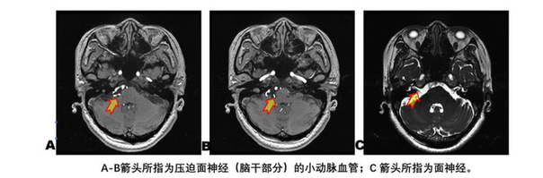 1600313678508426.png QQ截图20200917113428.png